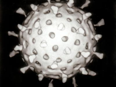 Antichinches Mallorca Control de plagas